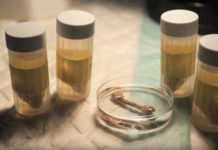 Une start-up israélienne fait pousser des os en laboratoire